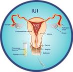 Gezocht! Sperma donor Midden Oosterse Etniciteit, Diensten en Vakmensen, Overige Diensten