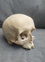 Schedel mens, Ophalen