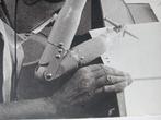 Fotogravure Prothese jaren 60/70, Ophalen of Verzenden