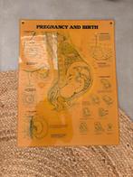 Anatomische Poster Zwangerschap en Geboorte, Antiek en Kunst, Ophalen of Verzenden, Natuur en Biologie