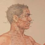 Acupuncture kaart, Ophalen of Verzenden