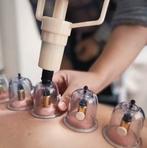 Women’s Care Acupuncture massage cupping Amsterdam