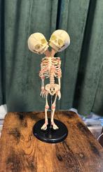 Siamese tweeling skelet replica - conjoined twins, Huis en Inrichting, Verzenden, Zo goed als nieuw