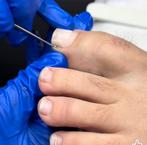 Voetverzorging/ pedicure, Ophalen of Verzenden, Nieuw