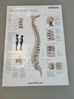 Anatomie poster, Ophalen, Zo goed als nieuw