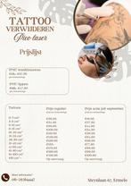 Tattoo weglaseren met picolaser aanbieding, Ophalen, Zo goed als nieuw, Handen en Nagels