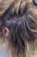 Klittenloos Haar Extensions Verwijderen, Ophalen of Verzenden, Nieuw, Pruik of Haarverlenging