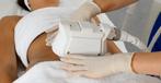 Cursus Cryolipolyse, Ophalen of Verzenden, Nieuw, Overige typen