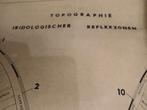 Topografie iridologische reflexzones, Ophalen, A1 t/m A3