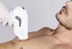 Diode ICE Laser kopen of leasen, Ophalen, Nieuw, Overige typen