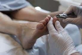 pedicure gezocht, Voetverzorging