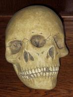 vergroeide Siamese tweeling REPLICA Schedel, freak skull NEP, Ophalen of Verzenden