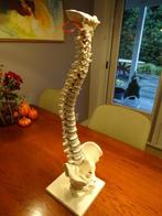 Model wervelkolom, Ophalen, Zo goed als nieuw, Overige typen