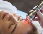 RF Lifting in Almere | Huidversteviging zonder chirurgie, Huidbehandeling