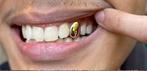 Gouden Tand Grillz - Nieuw !, Ophalen of Verzenden, Nieuw, Goud