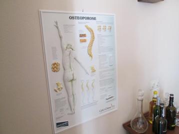 Anatomische Kaart Grafiek over Osteoporose 54x74 cm 3 dimens beschikbaar voor biedingen