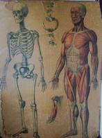 Anatomische plaat., Ophalen