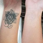 Laser tatoeage verwijderen veilig & effectief tattoo laseren, Ophalen of Verzenden, Nieuw