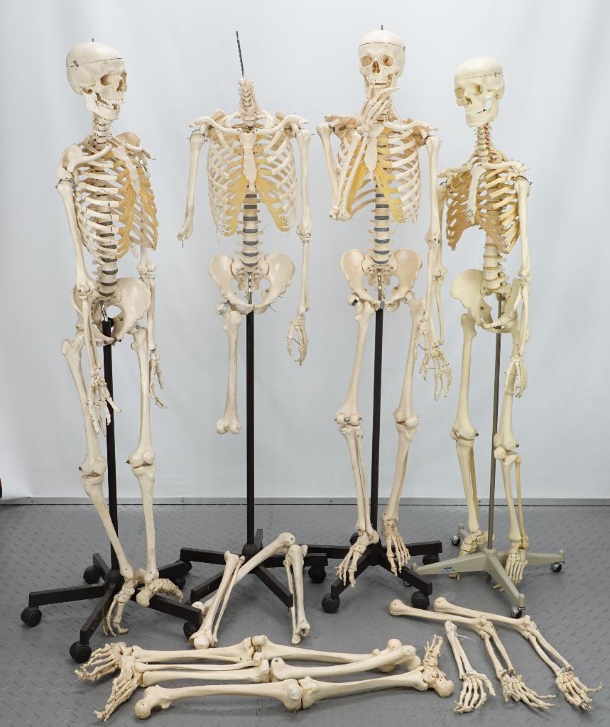 anatomisch skelet, 3x somso + 1x depex + onderdelen, Antiek en Kunst, Ophalen, Natuur en Biologie