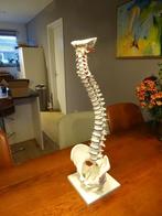 Model wervelkolom, Ophalen, Zo goed als nieuw