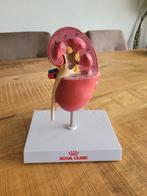 Anatomisch model nier - Gezond  & Tumor, Diversen, Schoolbenodigdheden, Ophalen of Verzenden, Zo goed als nieuw
