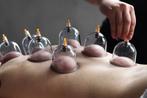 Hijama, Ophalen of Verzenden