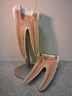 Medisch model kies, Antiek en Kunst, Ophalen of Verzenden