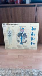 Antieke Duitse medische Schoolposter Portale Hypertensie, Ophalen, Natuur en Biologie