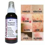 AlkaDerm Topical Spray Skin Treatment Topische Spray, Ophalen of Verzenden, Nieuw, Overige typen
