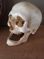 Anatomie schedel mens antiek, Antiek en Kunst, Curiosa en Brocante, Ophalen of Verzenden