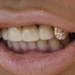 Gouden tand, Nieuw, Ophalen of Verzenden