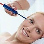 Weyergans facial star, Ophalen, Nieuw, Gehele gezicht, Verzorging