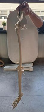 Anatomisch model been met heup.