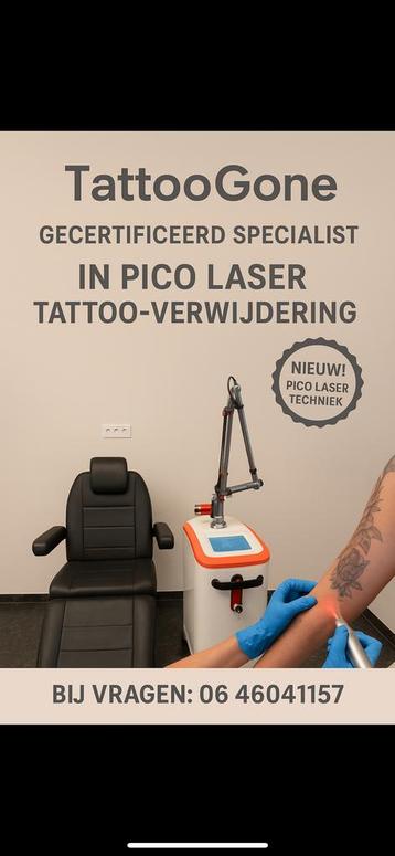 Gecertificeerd tattoo verwijderen voor vragen 0646041157 beschikbaar voor biedingen