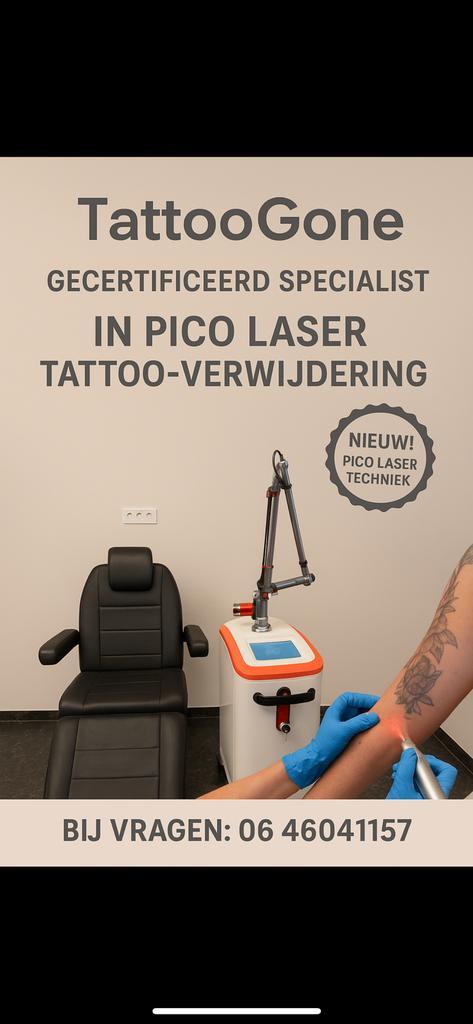 Gecertificeerd tattoo verwijderen voor vragen 0646041157, Hobby en Vrije tijd, Knutselen, Nieuw, Ophalen
