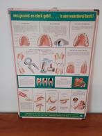 poster karton wandplaat gezond gebit schoolplaat tandarts, Natuur en Biologie, Ophalen of Verzenden