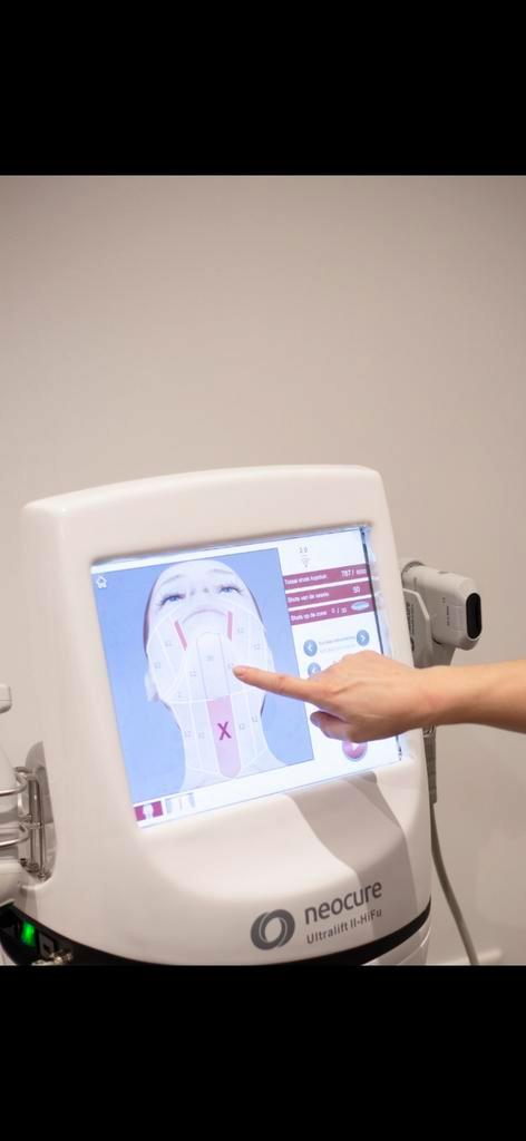 HIFU CELESTETIC Ultralift II - Huidverjonging, Witgoed en Apparatuur, Overige Witgoed en Apparatuur, Nieuw, Ophalen of Verzenden