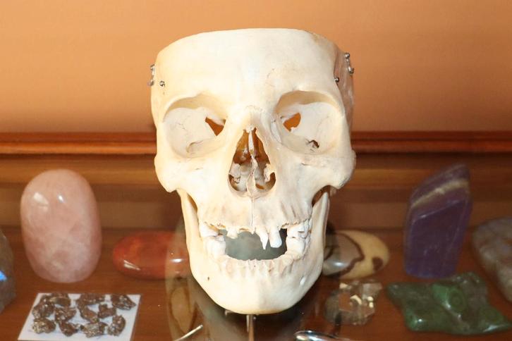 Oude Medische Mensen Schedel, Antiek en Kunst, Curiosa en Brocante, Verzenden