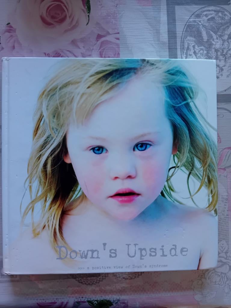 Down's Upside: A Positive View of Down's Syndrome Boek, Boeken, Ophalen of Verzenden, Zo goed als nieuw, Onbekend