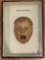 Oud zeldzaam  wassen Kinderhoofd anatomisch model .+-1945, Verzenden