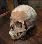 Schedel mens mensenschedel voor educatieve doeleinden, Verzamelen, Ophalen of Verzenden, Zo goed als nieuw, X, X