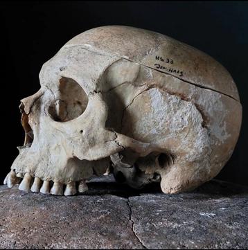 Schedel mens gevraagd, voor educatief doel. mensenschedel  beschikbaar voor biedingen