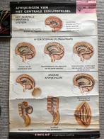 Medische verloskunde kinder neonatologie posters vintage, Ophalen of Verzenden, Gebruikt, Rechthoekig Staand