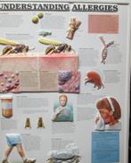 Medische plaat  "ALLERGIES" in kunststof, Antiek en Kunst, Antiek | Schoolplaten, Natuur en Biologie, Ophalen