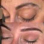 Epileren, Ophalen, Nieuw