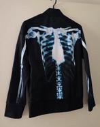 Adidas Originals Jeremy Scott Skeleton track jacket, Ophalen of Verzenden, Gedragen, Adidas