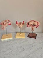 Anatomie modellen 3   stuks Foetus in de baarmoeder, Verzenden