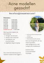 Acne model gezocht, Vacatures, Overige niveaus, Starter, Overige vormen