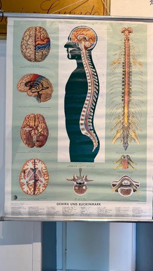 vintage medische schoolplaten posters, Antiek en Kunst, Antiek | Schoolplaten, Natuur en Biologie, Ophalen of Verzenden