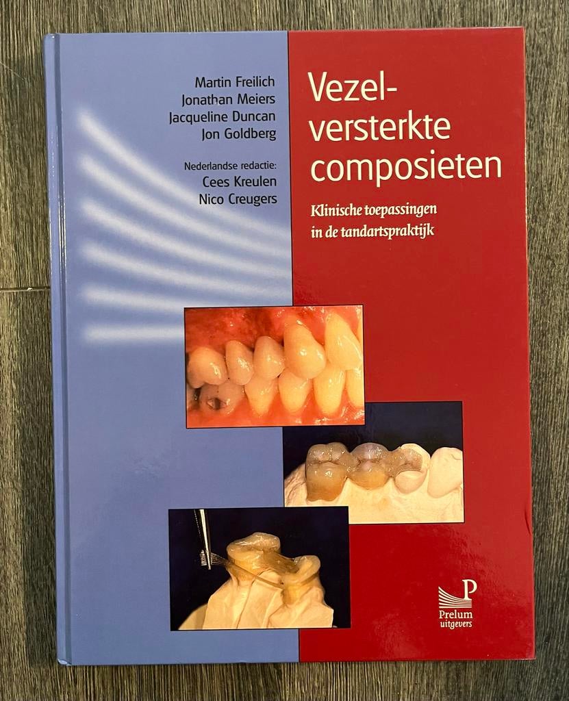 Vezelversterkte composieten nieuw, Ophalen of Verzenden, Beta, Nieuw, WO